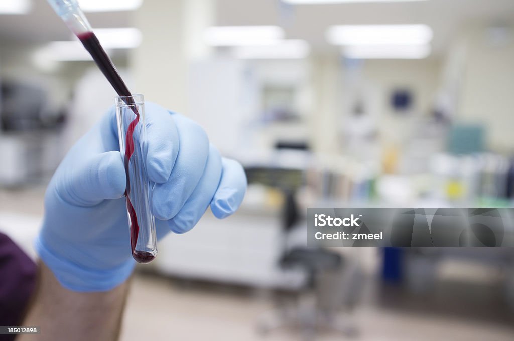 Pipetting amostra de sangue - Foto de stock de Análise ao sangue royalty-free