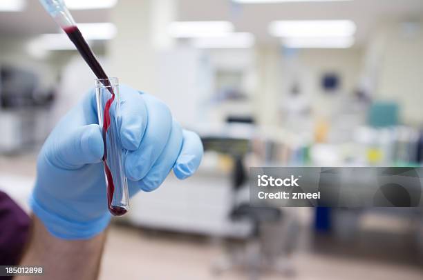 Foto de Pipetting Amostra De Sangue e mais fotos de stock de Análise ao sangue - Análise ao sangue, Ciência, Equipamento de laboratório