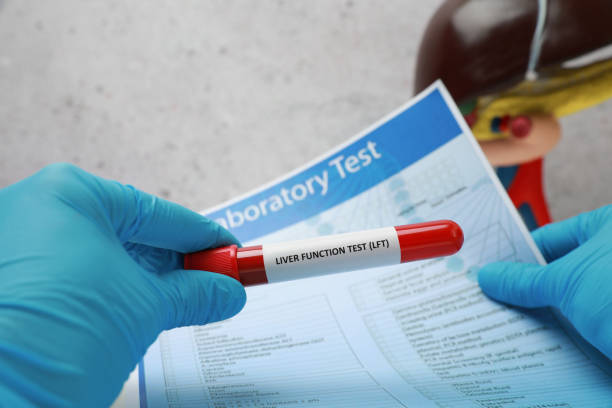 istock Liver Function Test. Laboratory worker holding tube with blood sample and form at table, closeup 1850479539