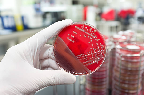 병원성 박테리아 - mrsa blood agar surgical glove microbiology 뉴스 사진 이미지