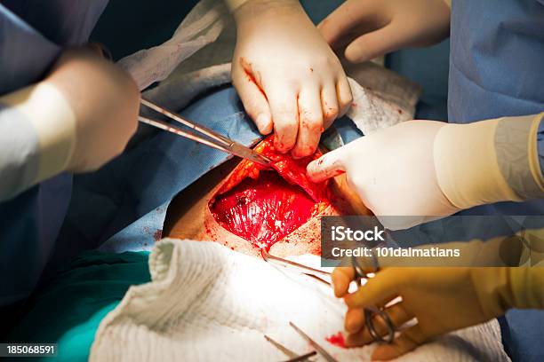 Taglio Cesareo - Fotografie stock e altre immagini di Ginecologo - Ginecologo, Intervento chirurgico, Anestetico