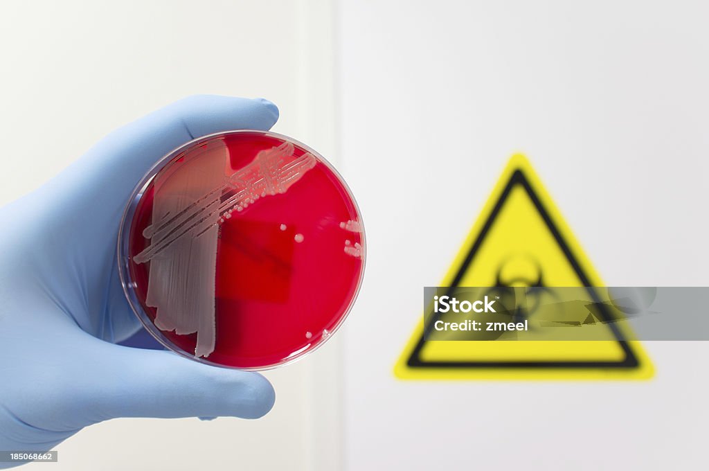 Pathogenic bacteria A hand with a blue medical glove is holding a agar plate with a culture of a pathogenic bacteria in front of a biohazard sign. Biohazard Symbol Stock Photo