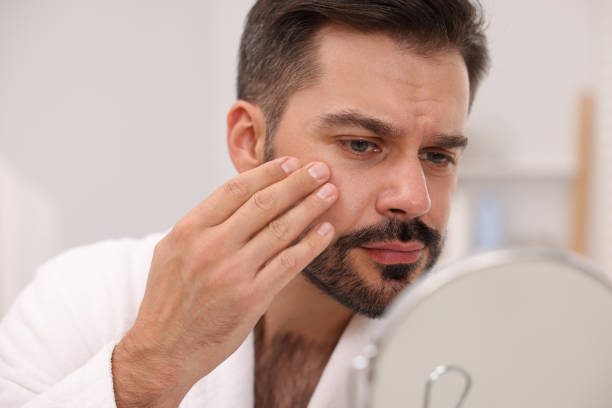 istock Confused man with skin problem looking at mirror indoors 1850706760