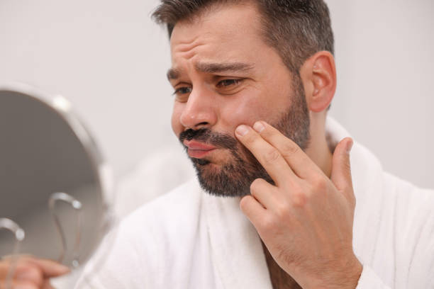 istock Confused man with skin problem looking at mirror indoors 1850707236