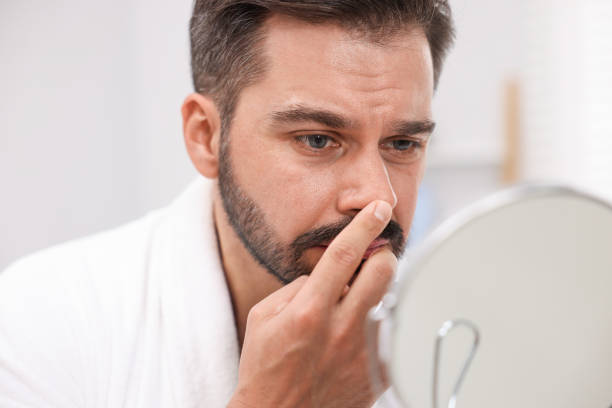 istock Man with skin problem looking at mirror indoors 1850707291