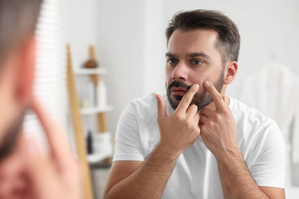 istock Confused man with skin problem looking at mirror indoors 1850707825