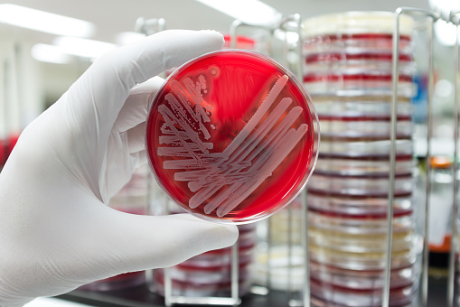A hand with a medical glove is holding a agar plate with a culture of a pathogenic bacteria.