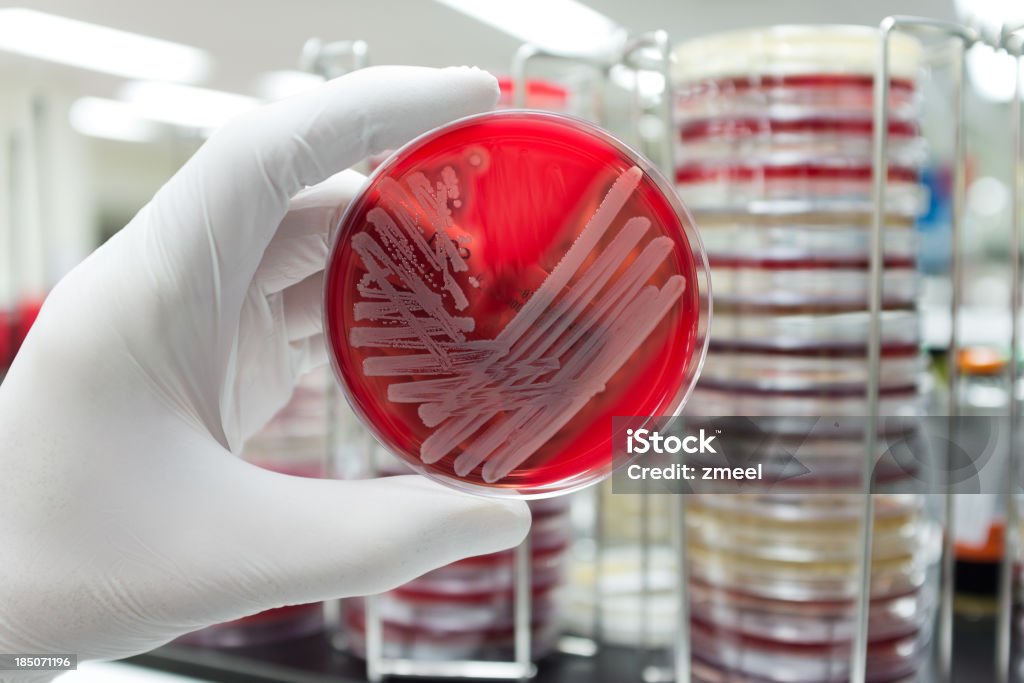 Pathogenic bacteria A hand with a medical glove is holding a agar plate with a culture of a pathogenic bacteria. Antibiotic Resistant Stock Photo