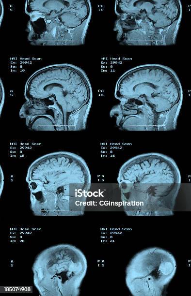 Mri De Cabezal De Barrido Foto de stock y más banco de imágenes de Anatomía - Anatomía, Artículo médico, Asistencia sanitaria y medicina