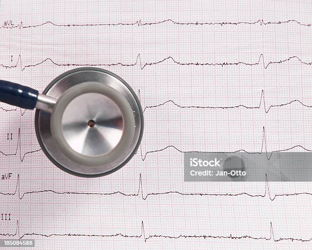 Electrocardiogramm Stockfoto und mehr Bilder von Bildhintergrund - Bildhintergrund, Diagramm, Dokument