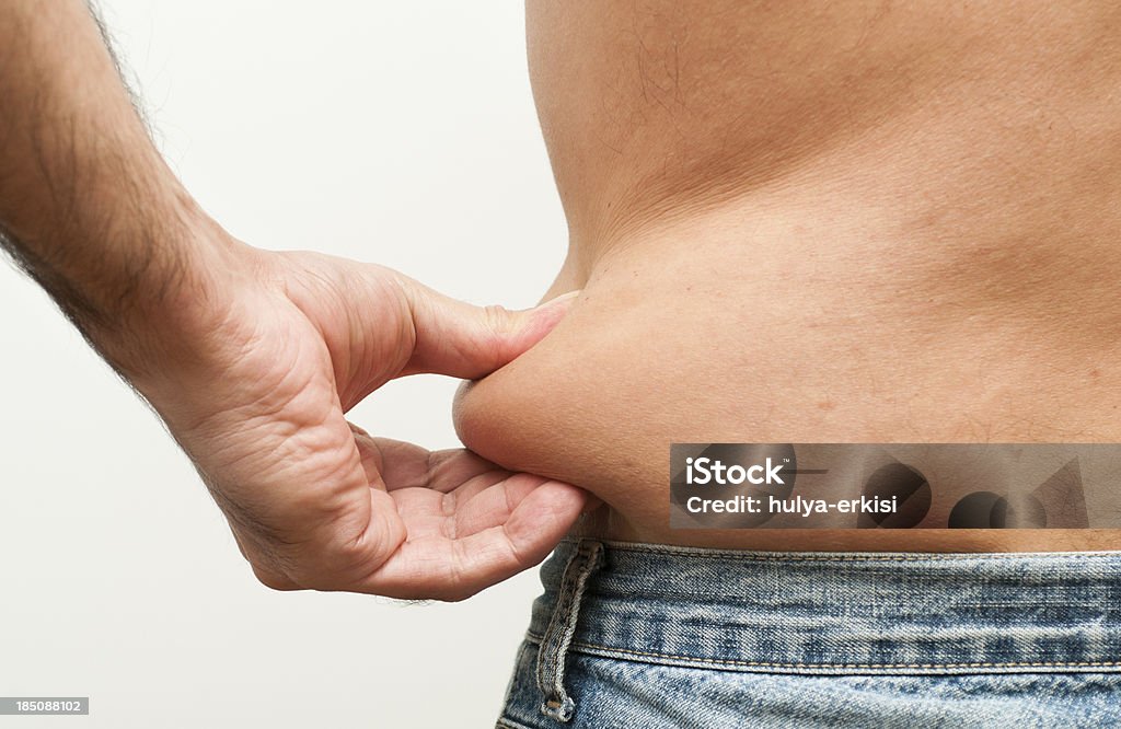Barriga de gordura - Royalty-free Lipoaspiração Foto de stock