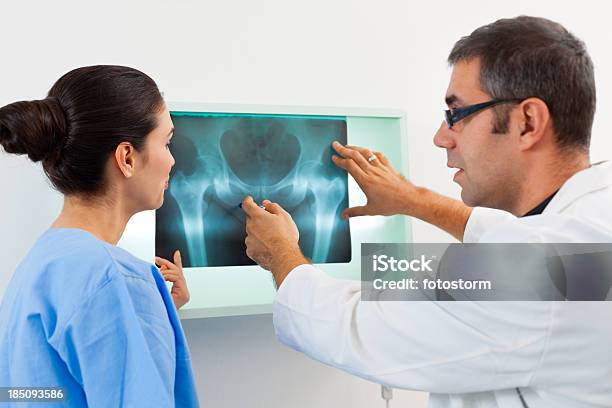 Arzt Untersuchen Röntgenbild Stockfoto und mehr Bilder von Hüfte - Hüfte, Arzt, Knochenbruch