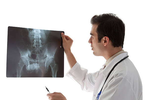 istock Doctor examining a Sacrum X-ray 185098347