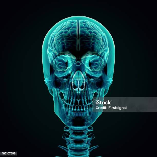 Human Brain Xray Style Stock Photo - Download Image Now - 3D Scanning, Anatomy, Auditory Cortex