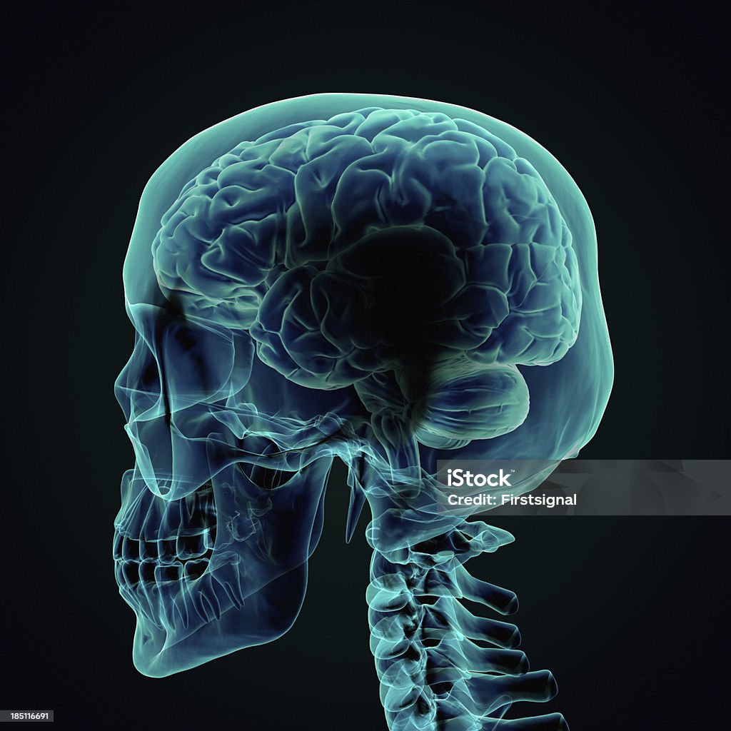 人間の脳の X 線スタイル - X線撮影のロイヤリティフリーストックフォト