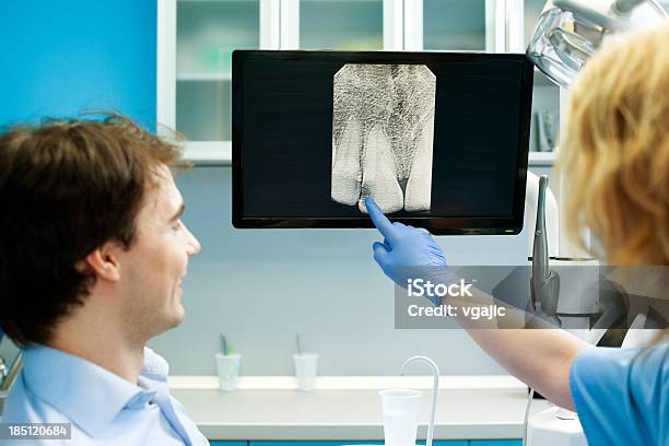 Dentista Professional Spiegare Immagine Radiografica Del Paziente - Fotografie stock e altre immagini di Accudire