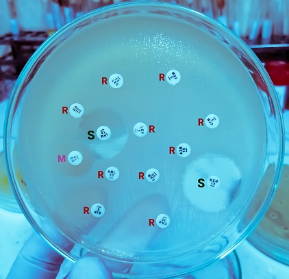 Antimicrobial susceptibility testing in petri dish, here R= Resistance, S= Sensitive and M= Modarate.