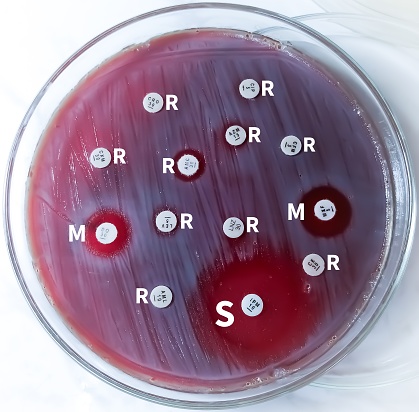 Antimicrobial susceptibility testing in petri dish, here R= Resistance, S= Sensitive and M= Modarate.