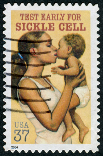 Cancelled Stamp From The United States Featuring An Appeal For Early Testing For Sickle Cell.