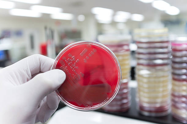 pathogenic bactérias - mrsa blood agar surgical glove microbiology - fotografias e filmes do acervo