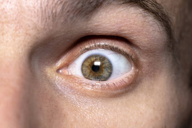 istock Red tyred men's eyes, close up. 1852295101
