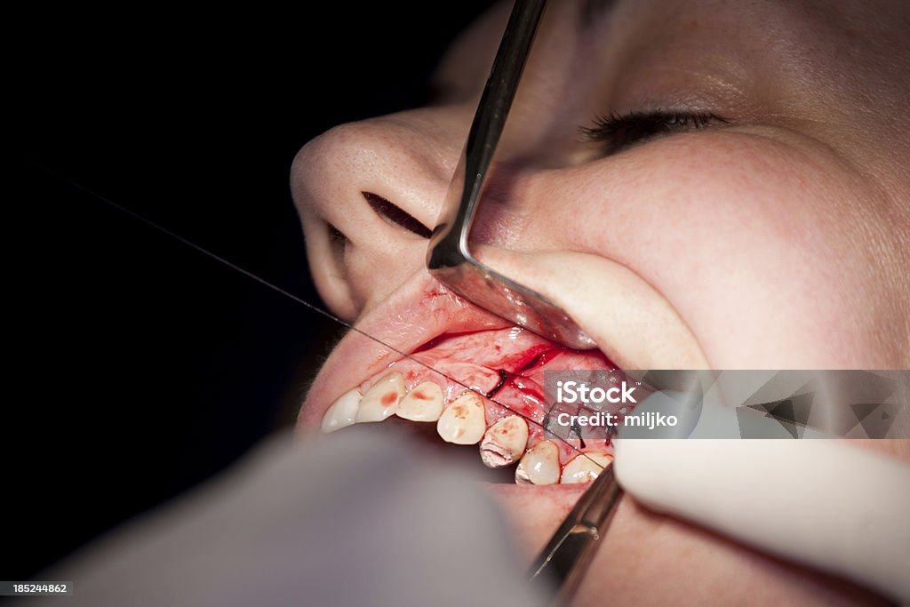 Chirurgia stomatologiczna - Zbiór zdjęć royalty-free (Badanie lekarskie)