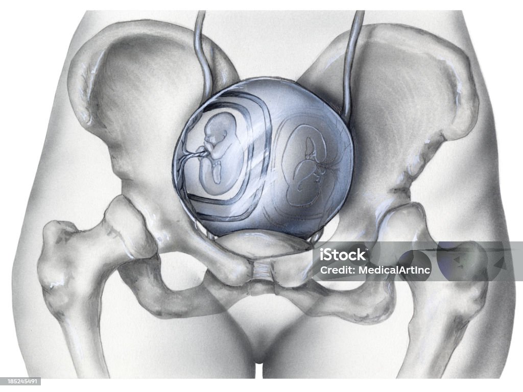 Плод в утробе матери-близнецы по сравнению с костей таза - Стоковые иллюстрации Амнион роялти-фри