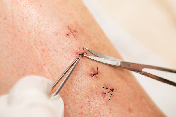 istock Nurse at work with patient after leg broken operation 185248517
