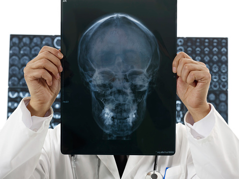 Male doctor looking  at x-ray.