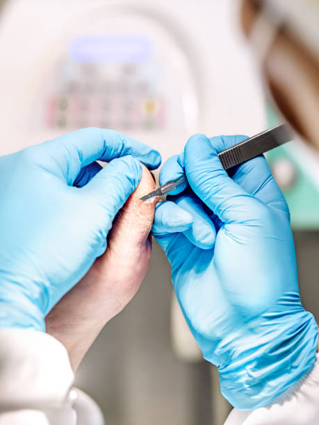 istock Close-up of a podiatry treatment. Selective focus 1852796384