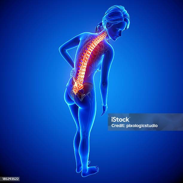 Kobieta Kręgosłupa Ból Widok Z Boku - zdjęcia stockowe i więcej obrazów Anatomia człowieka - Anatomia człowieka, Biologia - Nauka, Ból