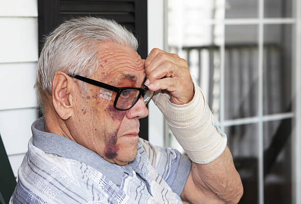 senior hombre con ojo negro - cardenal lesión física fotografías e imágenes de stock