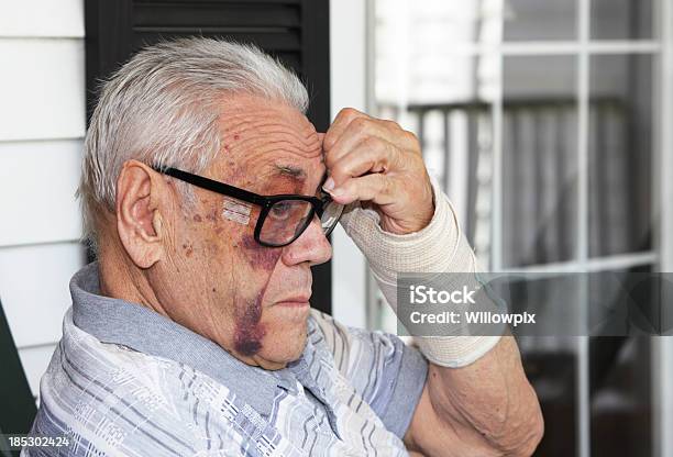 Senior Man With Black Eye Stock Photo - Download Image Now - Senior Adult, Bruise, Physical Injury