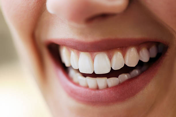 bellissima sorriso - human teeth whitening dentist smiling foto e immagini stock