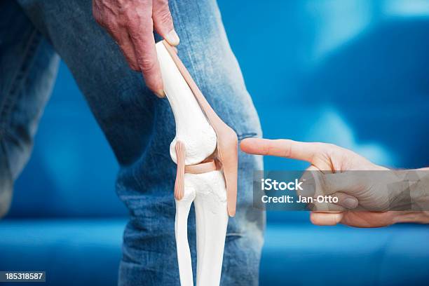 Articulação Do Joelho Humano - Fotografias de stock e mais imagens de Cartilagem - Cartilagem, Joelho, Rótula