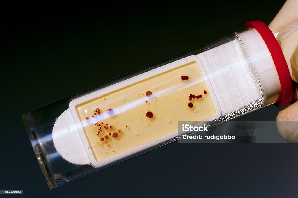 Microbiología tubo de ensayo - Foto de stock de Agar-agar libre de derechos