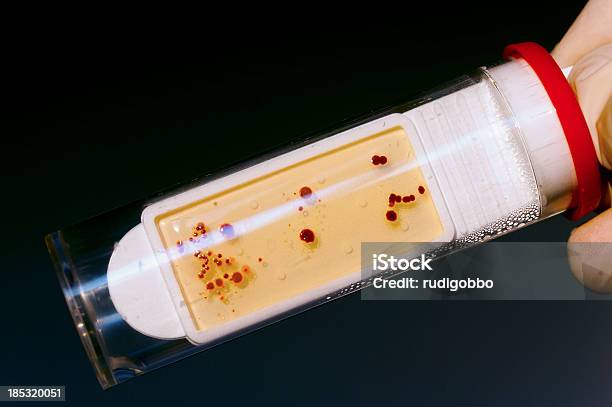 미생물 처리 테스트 튜브 과학에 대한 스톡 사진 및 기타 이미지 - 과학, 군체, 독성 물질