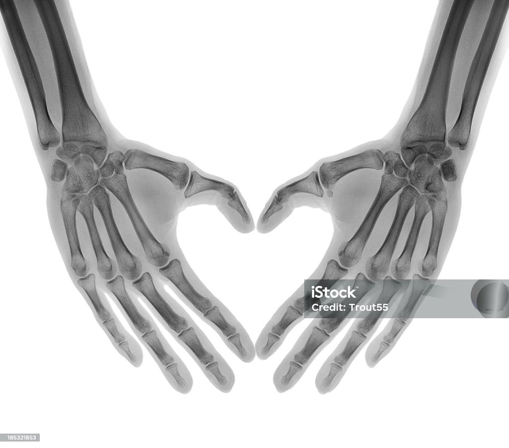 Negative X-ray - Human palms folded in a heart shape "Negative X-ray - Human palms folded in a heart shape. The pictures was taken by modern, hi-resolution digital X-ray medical equipment." X-ray Image Stock Photo