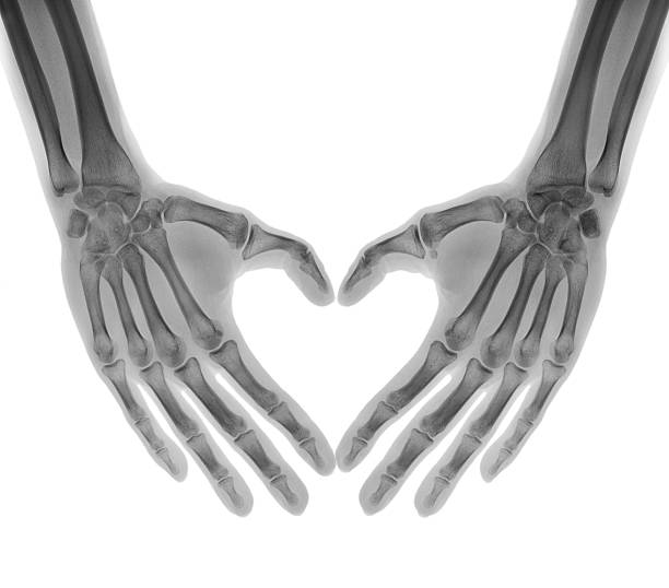 Negative X-ray - Human palms folded in a heart shape stock photo