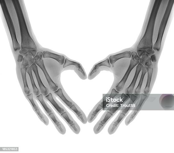 Negative Xray Human Palms Folded In A Heart Shape Stock Photo - Download Image Now