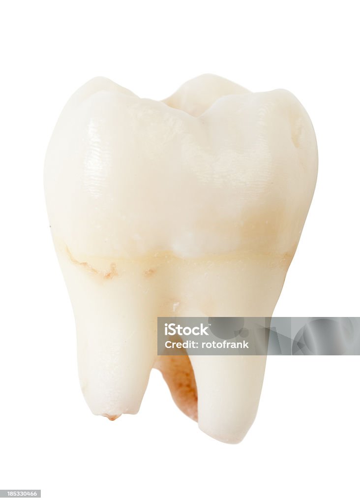 Weisheit Zahn oder Dritte molar - Lizenzfrei Zahnarzt Stock-Foto