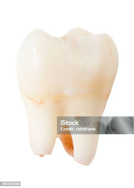 Weisheit Zahn Oder Dritte Molar Stockfoto und mehr Bilder von Zahnarzt - Zahnarzt, Wurzel, Buckel