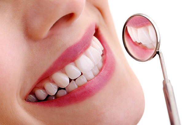 beautiful smile with dental mirror