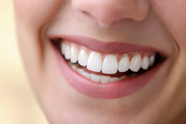 bellissima sorriso - human teeth whitening dentist smiling foto e immagini stock