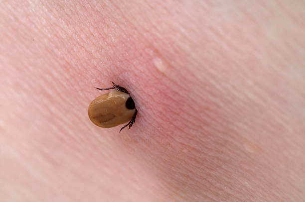 Seleziona bloccato in pelle - foto stock