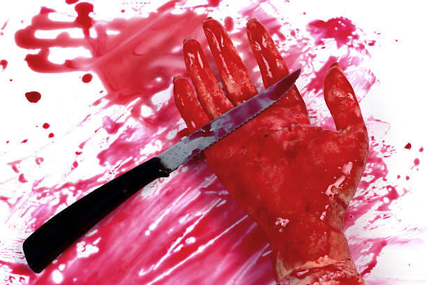 istock Bloody hand and a knife 11 185449944