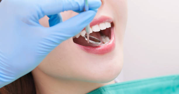 istock dentist check asian woman teeth 1855104697