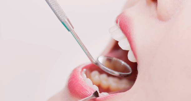 istock dentist check asian woman teeth 1855105212