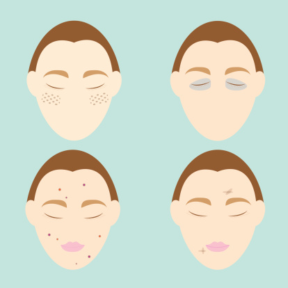Face Problem Sample Woman Face Problems On Blue Background Stock Illustration - Download ...