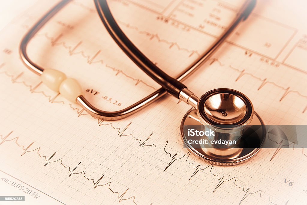 Heartbeat - Foto de stock de Analisar royalty-free